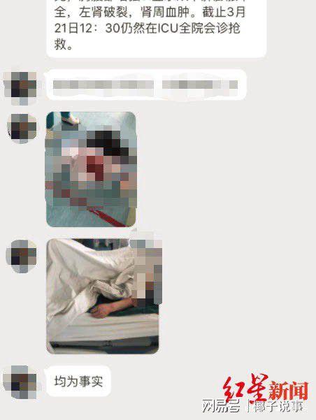 医生爆料透析病人视频,揭秘透析过程中的心酸与希望